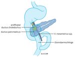 Zwölffingerdarm erhaltende Pankreaskopfresektion